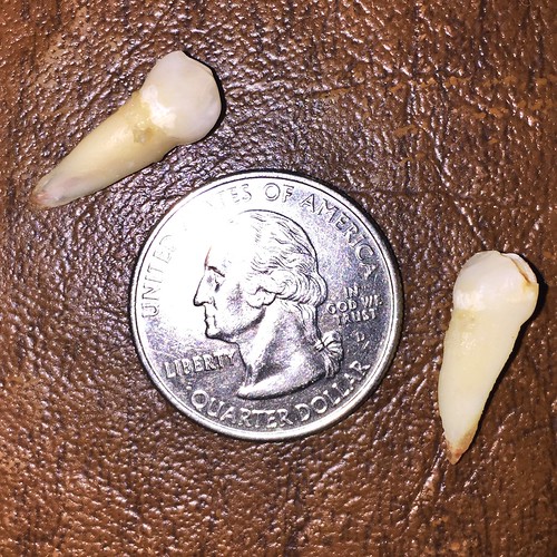 Tooth Fairy